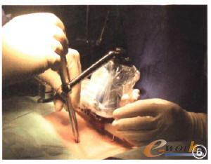 �ǿ����g�C����ϵ�y-Spinebot�������g���ֲ��ϵ�y